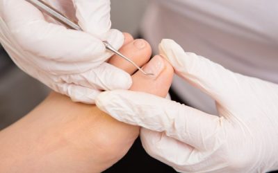 PODOLOGOA ABUZTUAREN 6an ETA BOLONDRESEN BILAKETA EGITASMO BATERAKO